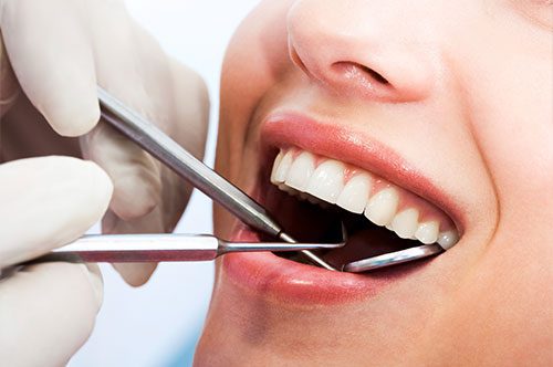 Dental Insurance Can Cover Your Spring Appointment