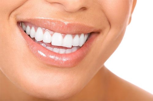 What’s Special About Professional Teeth Whitening? [BLOG]