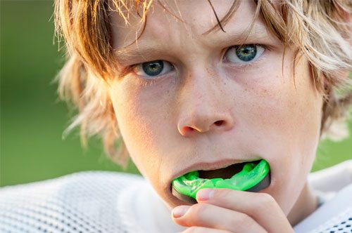 Protect Teeth Better With Custom Sports Mouthguards | Punta Gorda, FL [Infographic]