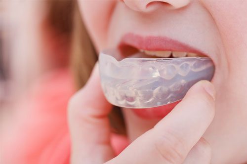 Are Clear Teeth Aligners Right for Me? [quiz]