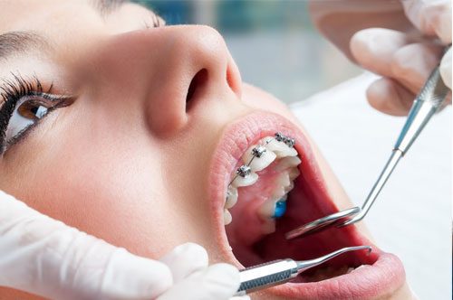 Do You Have A Preventive Dentistry Plan?