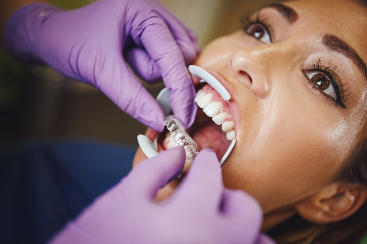 What Issues Can Invisalign Fix?