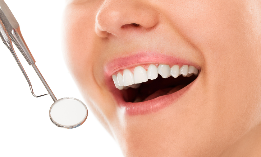 3 Things You Should Avoid After Teeth Whitening