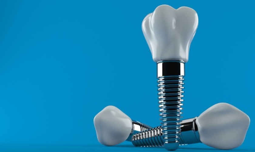 <strong>Why Choose Dental Implants To Replace Teeth?</strong>