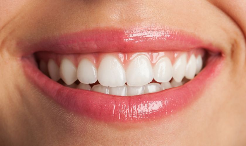 Preserving Your Picture-Perfect Smile: Essential Care Tips for Dental Veneers