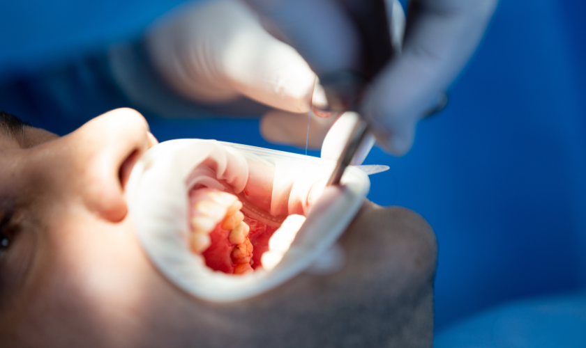The Benefits of Oral Surgery: Improving Your Oral Health and Quality of Life