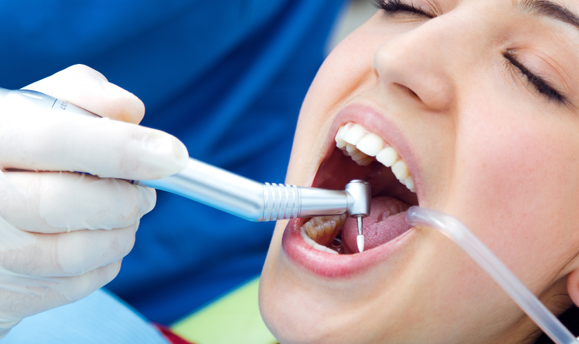 Easing the Anxiety: What to Expect During Your Root Canal Procedure