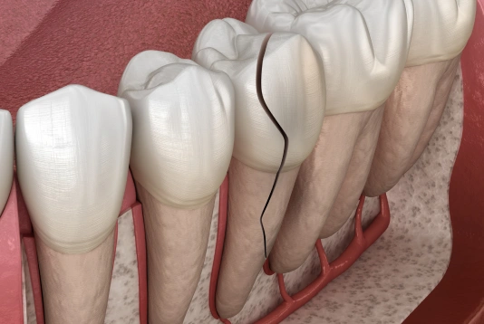 img Do You Need an Emergency Dentist