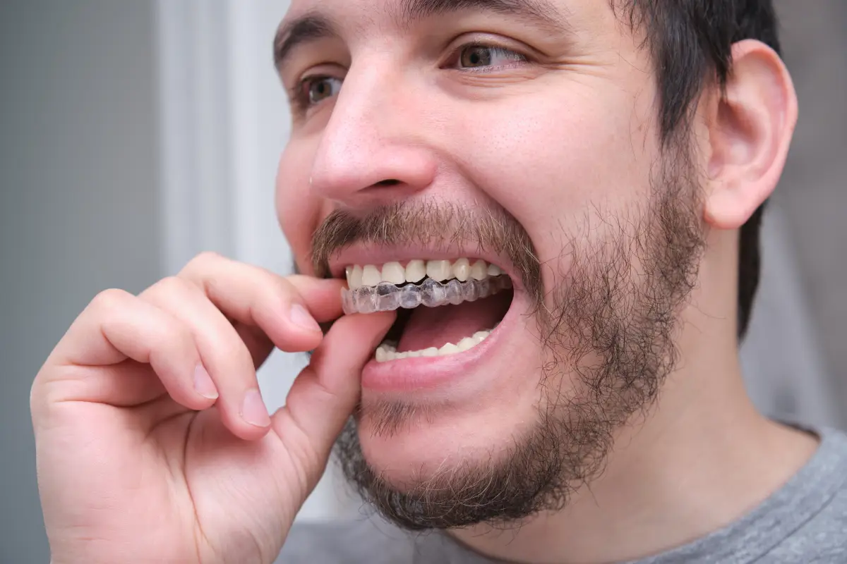 Invisalign for Adults: Why More People Are Making the Switch