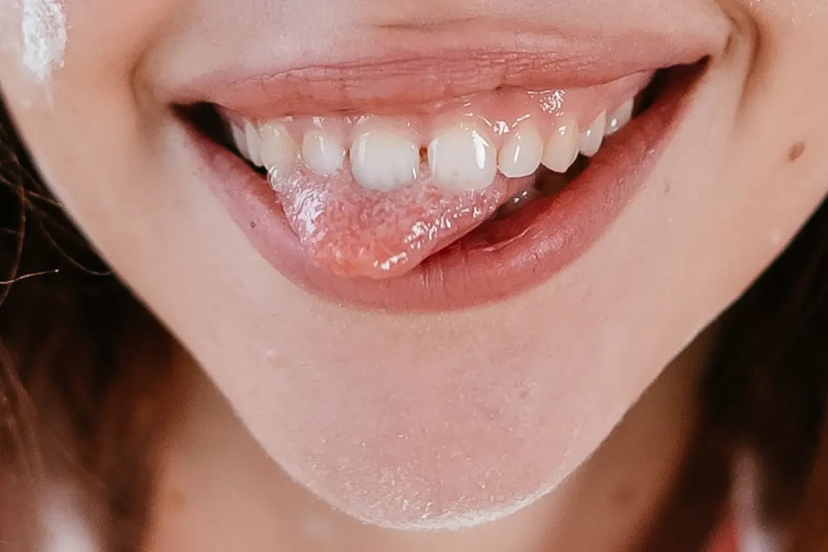 What’s Causing the Gap Between My Front Teeth?